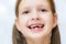 Funny toothless girl laughing with his mouth open