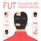 FUT and FUE hair transplantation process isolated