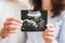 Future parents holding ultrasound scan of their future baby
