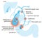 Gallstone disease. gallstones blocking bile duct and pancreatic duct. Labeled Illustration