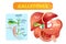 Gallstones anatomical cross section vector illustration diagram with abdominal cavity and gallbladder, bile ducts and duodenum.