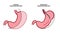 Gastrectomy and gastroplasty