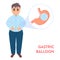 Gastric balloon weight loss procedure shown in stomach of a man