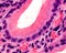 Gastric pit. Foveolar cells