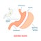 Gastric sleeve bariatric surgery weight loss infographics