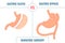 Gastric sleeve vs gastric bypass bariatric surgery weight loss infographics