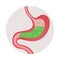 Gastritis Symptom Icon