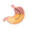 Gastroscopy. Endoscopy and digestive problems. Hose with camera. Procedure with internal organs