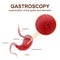 Gastroscopy procedure EGD