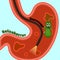 Gastroscopy, research of a stomach gastroscope.