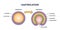 Gastrulation as early developmental process for embryo tiny person concept