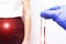 A geneticist doctor holds a test tube with an egg against the background of a girl whose patient is doing in vitro