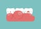 Gingivitis around the teeth ,dental concept