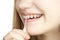 Girl cleans the braces with a toothbrush, close-up, on a white background