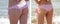 Girl figure in a swimsuit slimming cellulite he alth loss oversize before and after the diet fitness