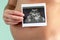 The girl is holding a snapshot of an ultrasound twin in the fourth week of pregnancy. First trimester. Confirmation of pregnancy.