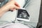 A girl holds a picture of an ultrasound baby in her twentieth week of pregnancy. Second trimester Selective focus