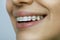 Girl with retainer on teeth