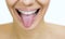 Girl with retainer for teeth sticking her tongue out