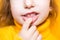 Girl shows her teeth-pathological bite, malocclusion, overbite. Pediatric dentistry and periodontics, bite correction. Health and