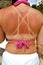 Girl with sunburned back