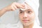 Girl with a white towel on her head in the bathroom, cleans her face with a cotton swab, close-up