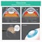 Glaucoma. Aqueous humour fluid exits and flow to canal of schlemm human eyes. Illustration.