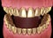 Golden teeth crowns over natural teeth. Medically accurate 3D illustration of human teeth