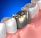 Golden Teeth Mouth Anatomy blue - 3d illustration