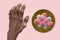 Gout-afflicted hands with deformities, 3D illustration