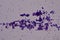 Gram positive cocci finding with microscope