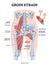 Groin strain trauma and pulled or torn muscle injury anatomy outline diagram