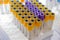 Group of medical sample tube yellow and purple color