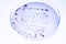 Growing Bacteria in Petri Dishes on agar gel Scientific experiment