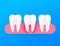 Gum disease, periodontitis. Healthy white tooth. Vector stock illustration