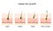 Hair growth cycle. Human skin. Follicle anatomy