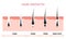 Hair growth cycle skin. Follicle anatomy anagen phase, hair growth diagram illustration