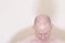 Hair loss male pattern baldness man with bald head on top