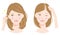 Hair parting thinning woman before after illustration. hair care and beauty concept