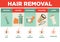 Hair removal or depilation vector poster