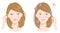 Hair and scalp odor young woman before after illustration. Hair care beauty concept