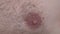 Hairy Male Nipple. Extreme Close Up