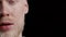 Half-Face Portrait Of Albino Guy Crying Posing On Black Background