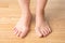 Hallux valgus, bunion in foot, pain in the legs