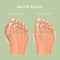 Hallux valgus vector medicine poster.