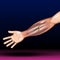 Hand Bone Fracture - Distal radius fracture and broken arm bone types anatomy - Vector Illustration