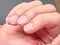 Hand of a child with weak or brittle fingernails, isolated on gray background, no faces are shown , close up look