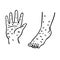 Hand foot  disease