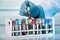 Hand holding tube of rack with blood test tubes in clinical lab