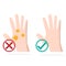 Hand infected and clean hand icon, hygiene concept